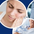 Pain Relievers: A Comprehensive Overview