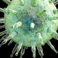 Epstein-Barr Virus: Causes, Symptoms, Diagnosis and Treatment