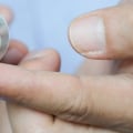 Corticosteroid Creams and Ointments: A Comprehensive Overview