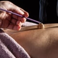 Acupuncture: An Overview of the Ancient Chinese Treatment